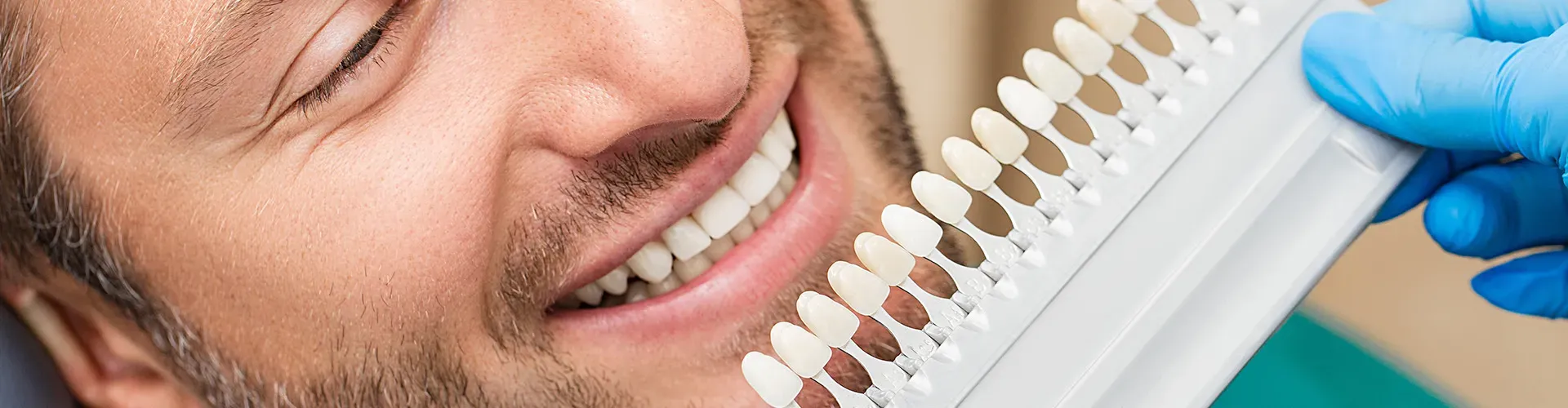 dentist holding shade-matching tool against patient's teeth