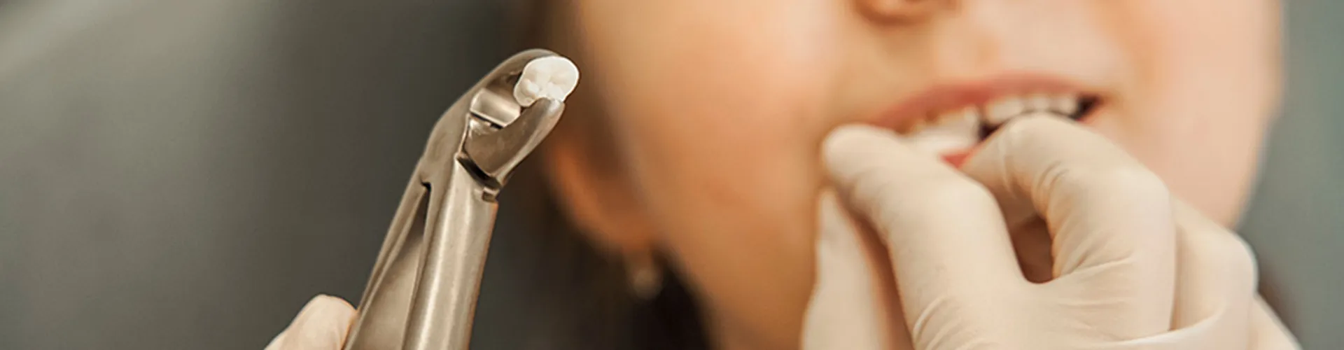 dentist holding extracted tooth in forceps in front of child