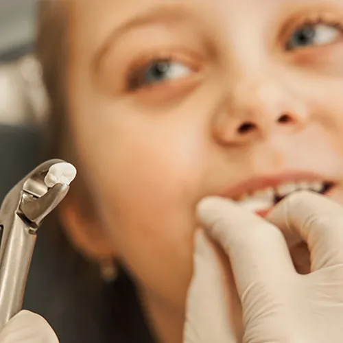 dentist holding extracted tooth in forceps in front of child